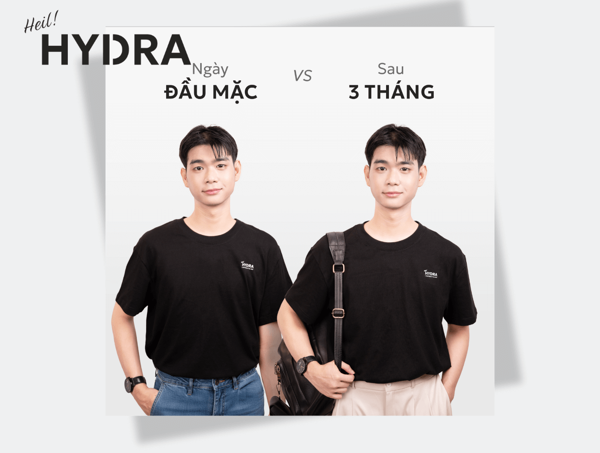 Đánh giá chi tiết áo thun Hydra Basic sau 3 tháng sử dụng